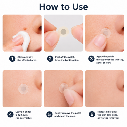 ✨Lumivo®2-in-1 Microneedle & Hydrocolloid Patch🍀| Removes Raised Moles, Acne, Flat Warts & Skin Tags | Helps Improve Wrinkles, Scars & Blemishes | Invisible Patches for Face & Body