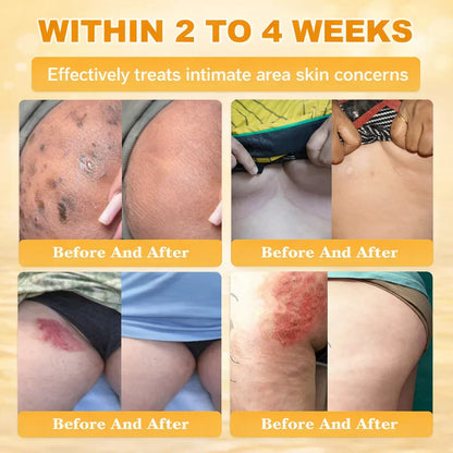 【70% OFF Wraps Up Today】LUMIVO® 🐄Tallow Bee Poison Healing Balm（Sorts Out Spots, Wrinkles & Knackered Skin — Steroid-Free）