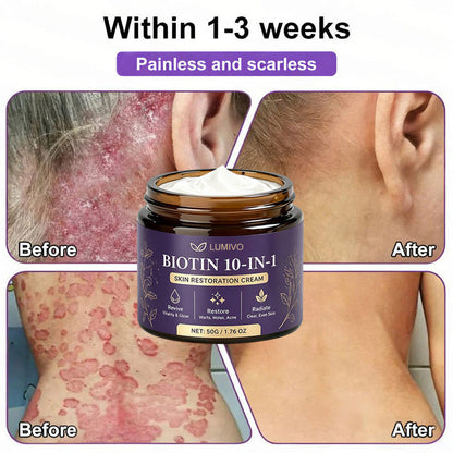 Made and Shipped from USA ✨LUMIVO® Biotin 10-in-1 Skin Restoration Cream 🍀