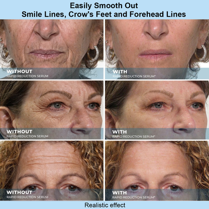 Lumivo™ Instant Face Temporary Tightener – Instant visible results in 30 seconds
