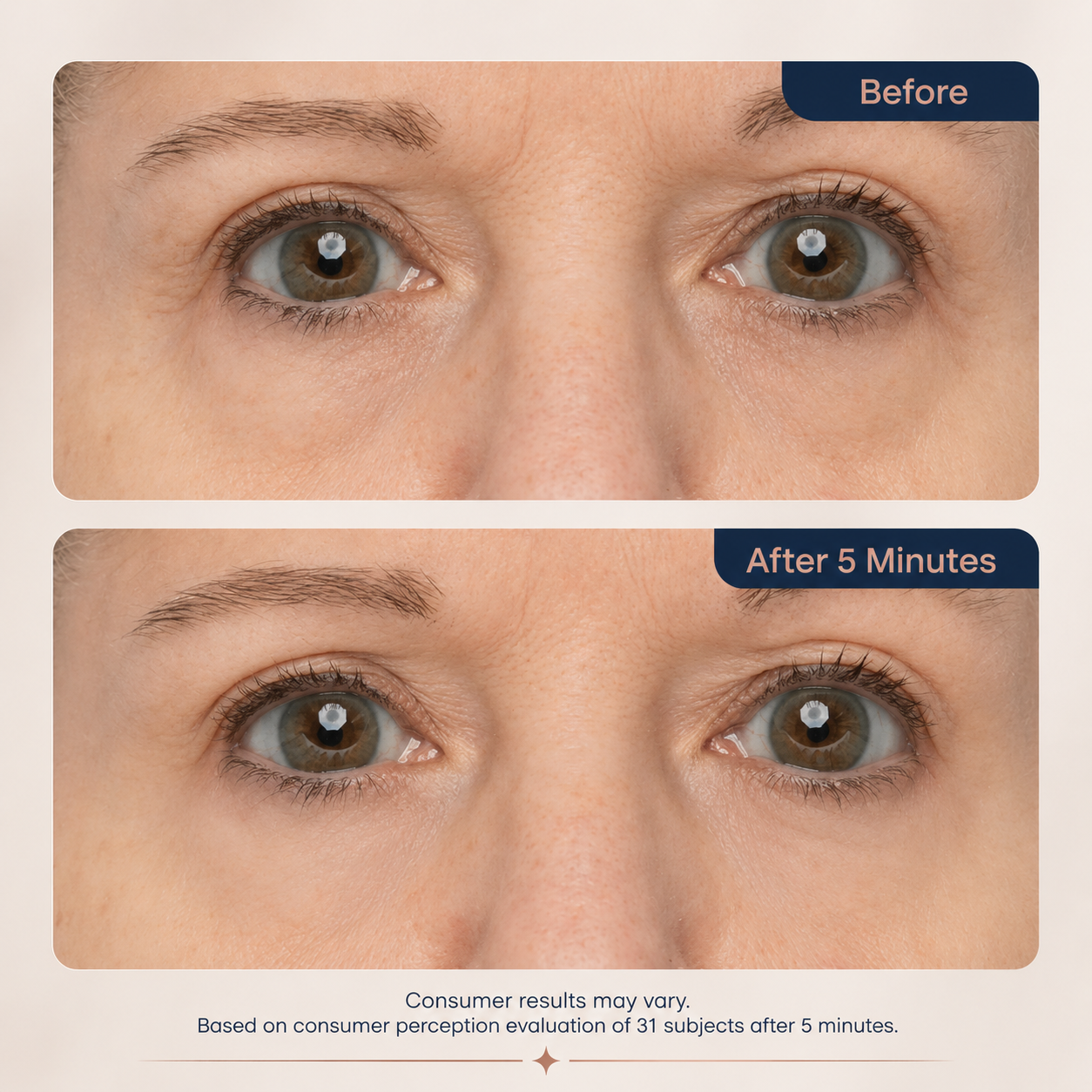 NEW! Lumivo™ Instant Lift Eye Gel - For Puffiness & Bags, Wrinkles, Fine Lines and Dark Circles, Anti Aging Skin Care for Men & Women with Collagen Targeting Biotech