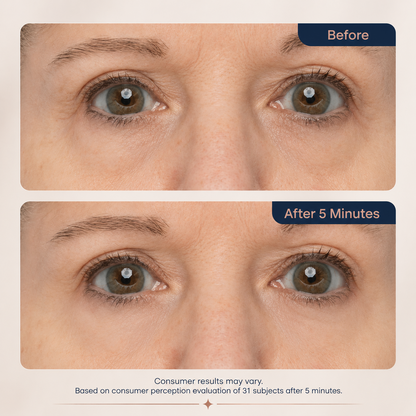 NEW! Lumivo™ Instant Lift Eye Gel - For Puffiness & Bags, Wrinkles, Fine Lines and Dark Circles, Anti Aging Skin Care for Men & Women with Collagen Targeting Biotech