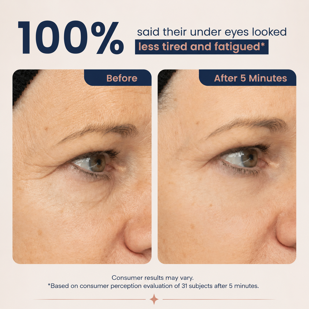 NEW! Lumivo™ Instant Lift Eye Gel - For Puffiness & Bags, Wrinkles, Fine Lines and Dark Circles, Anti Aging Skin Care for Men & Women with Collagen Targeting Biotech