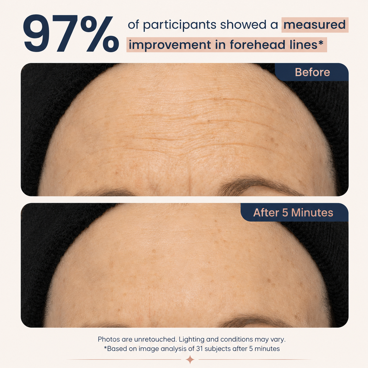NEW! Lumivo™ Instant Lift Eye Gel - For Puffiness & Bags, Wrinkles, Fine Lines and Dark Circles, Anti Aging Skin Care for Men & Women with Collagen Targeting Biotech