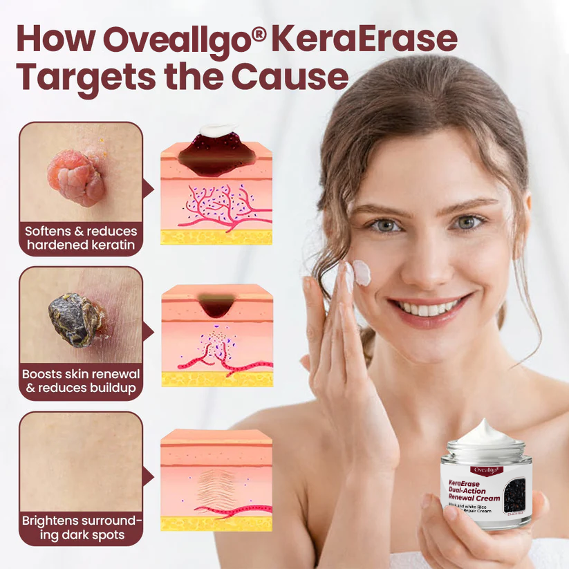 Lumivo® KeraErase PRO Dual-Action Renewal Cream