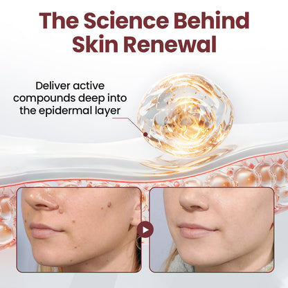 Lumivo® KeraErase PRO Dual-Action Renewal Cream