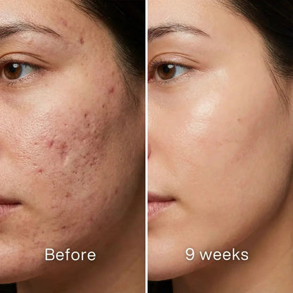 🏆#1 Best Seller ⏰ Scar Renewal - Advanced Medical Silicone