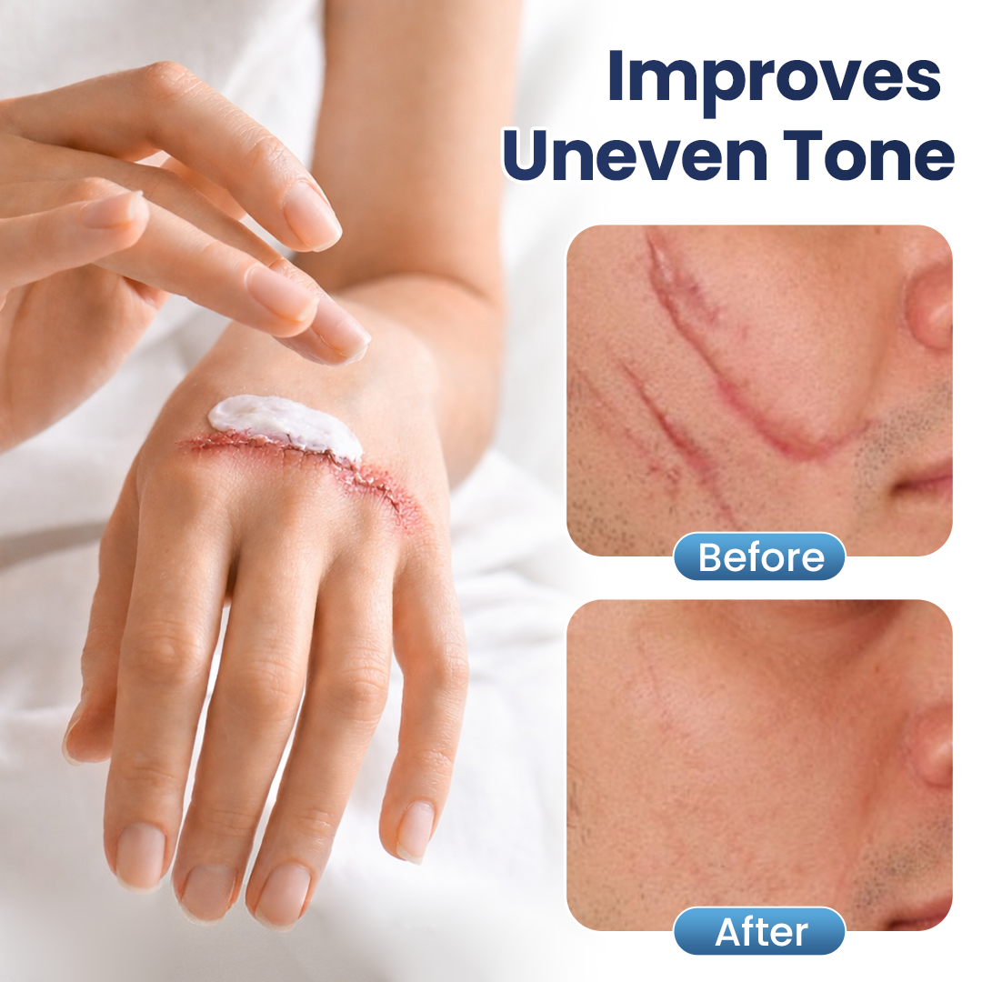 𝑶𝒇𝒇𝒊𝒄𝒊𝒂𝒍 𝑺𝒕𝒐𝒓𝒆 | LUMIVO® Texture Repair Gel — Say Goodbye to Stubborn Scars & Uneven Texture in 4 Weeks
