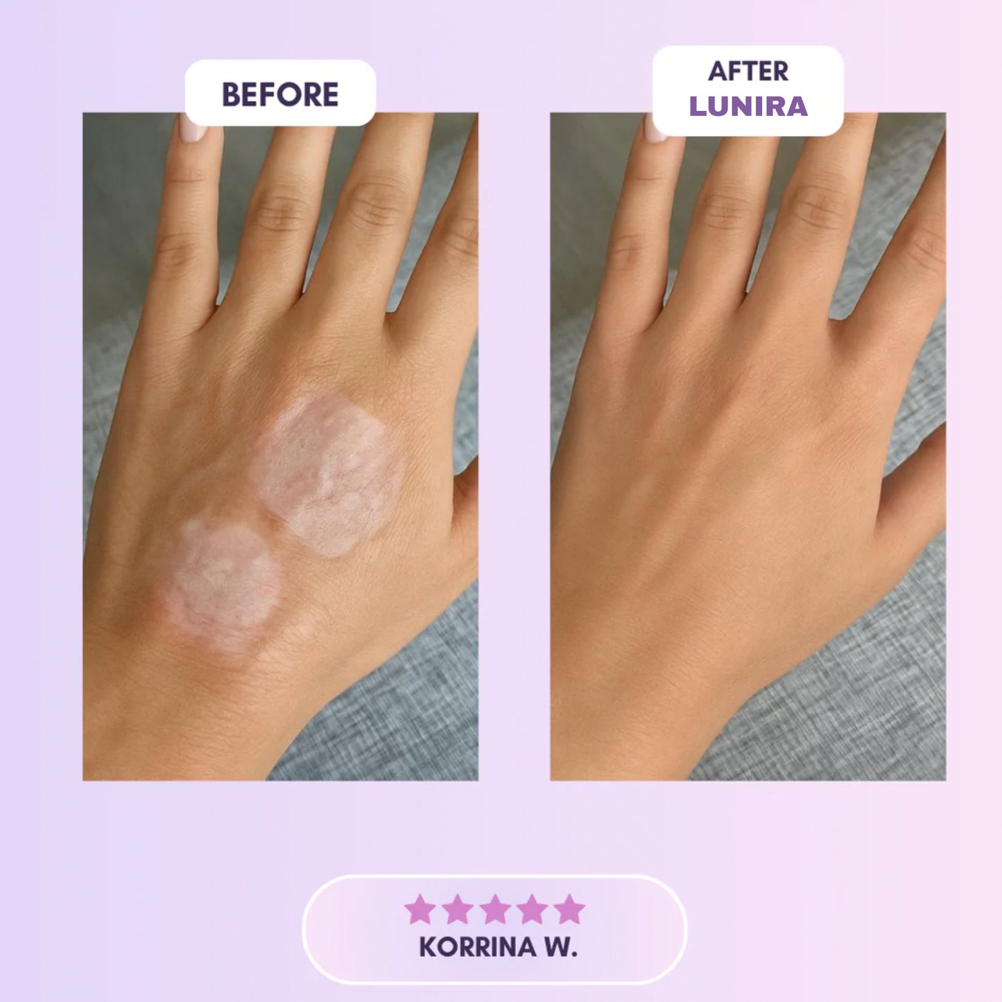 Final 3 Hours: 60%OFF🔥 Silicone Wrinkles Patch