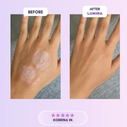 Final 3 Hours: 60%OFF🔥 Silicone Wrinkles Patch