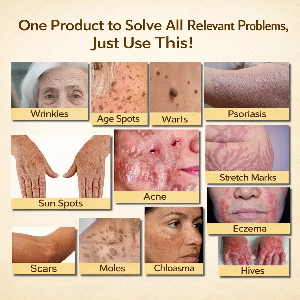 【70% OFF Wraps Up Today】LUMIVO® 🐄Tallow Bee Poison Healing Balm（Sorts Out Spots, Wrinkles & Knackered Skin — Steroid-Free）
