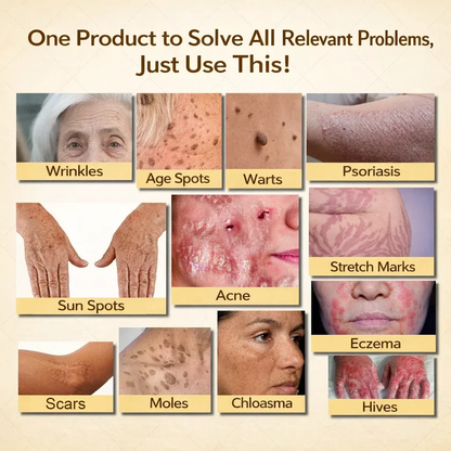 【70% OFF Wraps Up Today】LUMIVO® 🐄Tallow Bee Poison Healing Balm（Sorts Out Spots, Wrinkles & Knackered Skin — Steroid-Free）