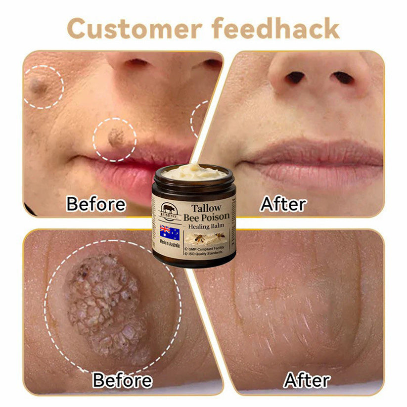 【70% OFF Wraps Up Today】LUMIVO® 🐄Tallow Bee Poison Healing Balm（Sorts Out Spots, Wrinkles & Knackered Skin — Steroid-Free）