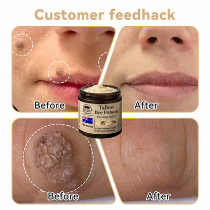 【70% OFF Wraps Up Today】LUMIVO® 🐄Tallow Bee Poison Healing Balm（Sorts Out Spots, Wrinkles & Knackered Skin — Steroid-Free）