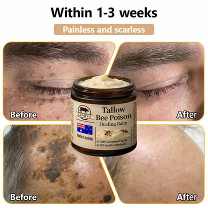 【70% OFF Wraps Up Today】LUMIVO® 🐄Tallow Bee Poison Healing Balm（Sorts Out Spots, Wrinkles & Knackered Skin — Steroid-Free）