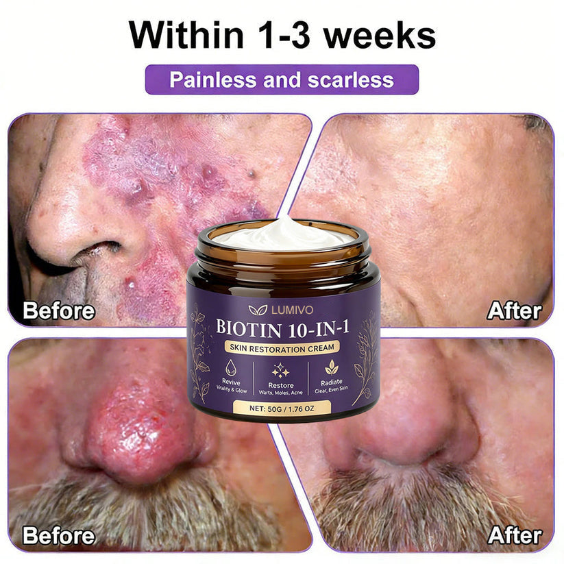 Made and Shipped from USA ✨LUMIVO® Biotin 10-in-1 Skin Restoration Cream 🍀