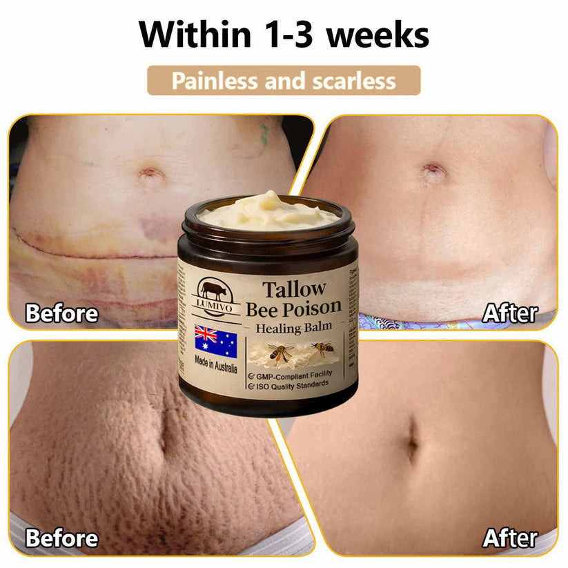 【70% OFF Wraps Up Today】LUMIVO® 🐄Tallow Bee Poison Healing Balm（Sorts Out Spots, Wrinkles & Knackered Skin — Steroid-Free）