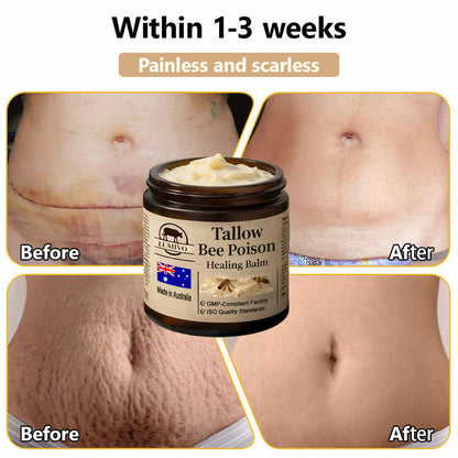 【70% OFF Wraps Up Today】LUMIVO® 🐄Tallow Bee Poison Healing Balm（Sorts Out Spots, Wrinkles & Knackered Skin — Steroid-Free）