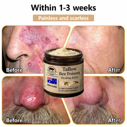 【70% OFF Wraps Up Today】LUMIVO® 🐄Tallow Bee Poison Healing Balm（Sorts Out Spots, Wrinkles & Knackered Skin — Steroid-Free）