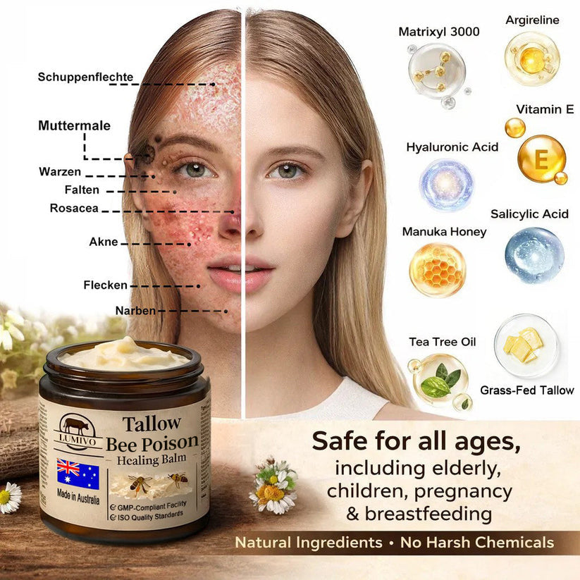 【70% OFF Wraps Up Today】LUMIVO® 🐄Tallow Bee Poison Healing Balm（Sorts Out Spots, Wrinkles & Knackered Skin — Steroid-Free）