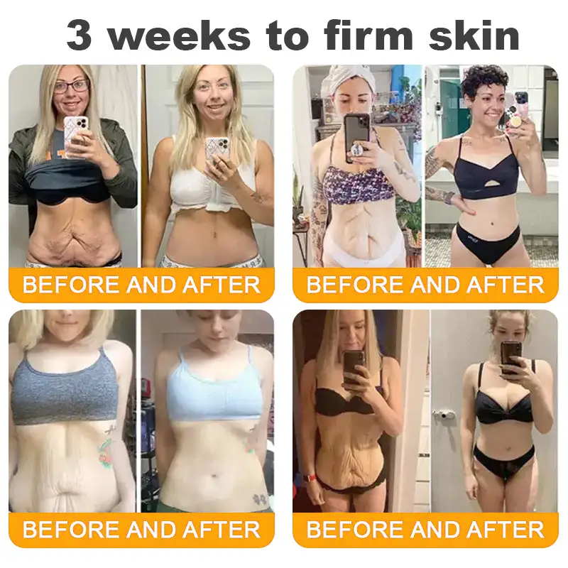 Bee Venom Lymphatic Patch – Flush Fat & Repair Skin While You Sleep Activate lymph drainage to reduce bloating, support metabolism, and restore clearer, healthier skin — no pills, no injections.