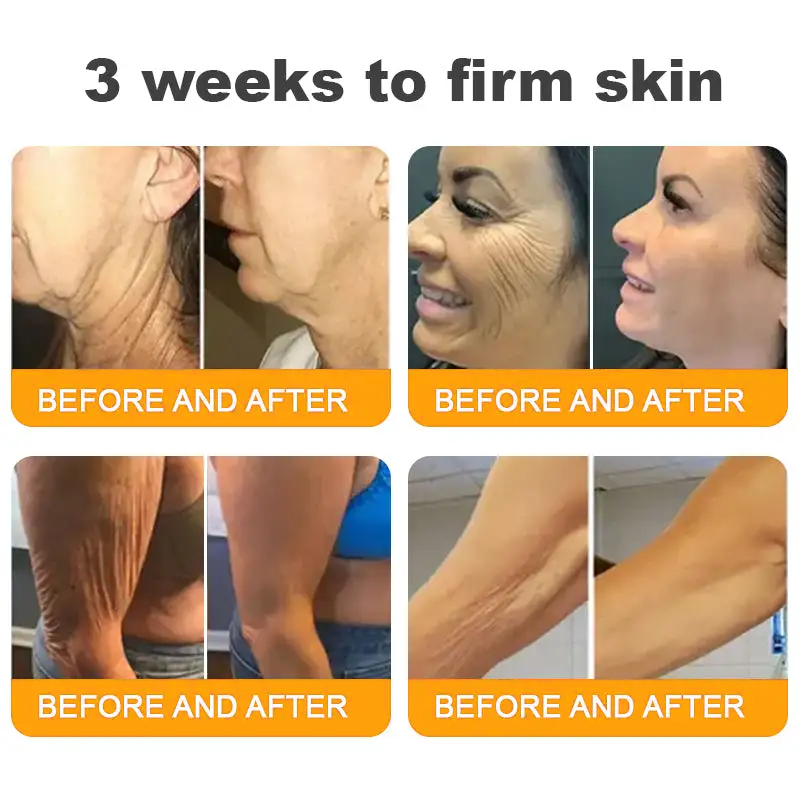 Bee Venom Lymphatic Patch – Flush Fat & Repair Skin While You Sleep Activate lymph drainage to reduce bloating, support metabolism, and restore clearer, healthier skin — no pills, no injections.