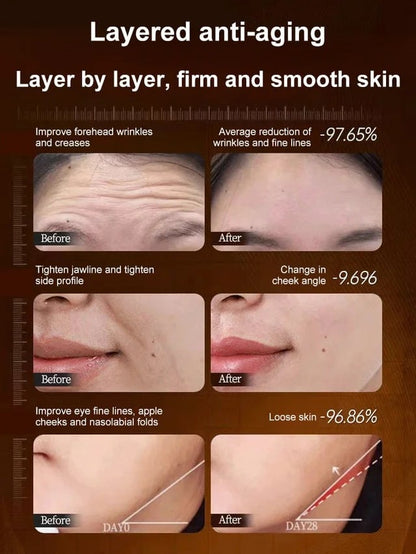 🔥Factory Direct $9.99 - Micro-molecular collagen anti-wrinkle lotion🔥