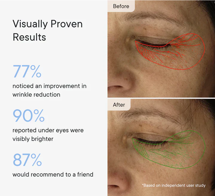 Micro-Infusion Facial Care Patches for Dark Circles, Puffiness, Fine Lines & Wrinkles✅