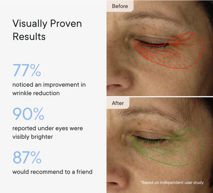 Micro-Infusion Facial Care Patches for Dark Circles, Puffiness, Fine Lines & Wrinkles✅