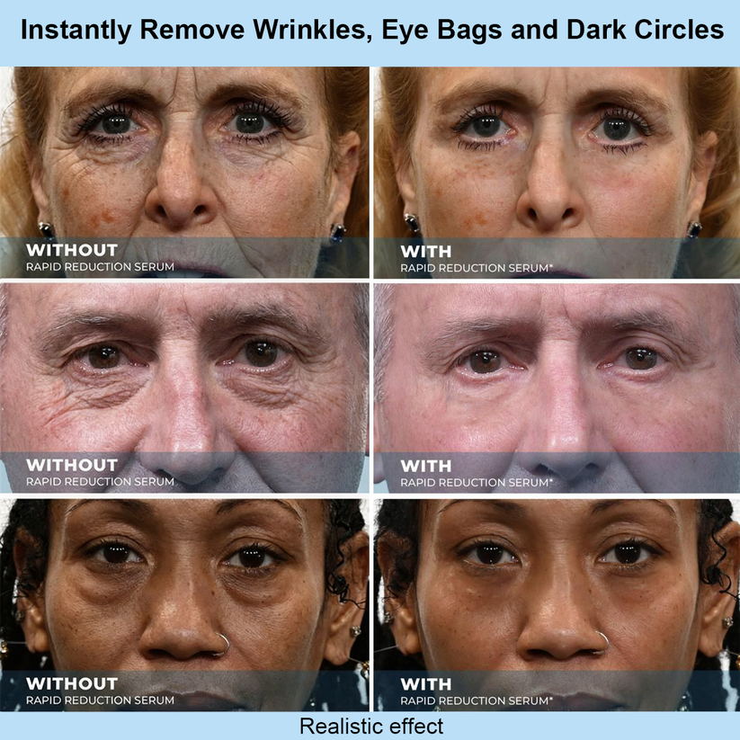 Lumivo™ Instant Face Temporary Tightener – Instant visible results in 30 seconds