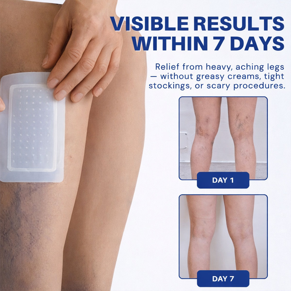 Lumivo® 𝑽𝗲𝗶𝙣 𝘾𝐨𝐧𝘁𝗼𝙪𝙧 𝙈𝙞𝐜𝐫𝒐𝒏𝒆𝗲𝗱𝗹𝙚 𝙋𝙖𝐭𝐜𝒉 𝒘𝒊𝘁𝗵 𝗔𝙙𝙫𝙖𝙣𝙘𝐞𝐝 𝐃𝒊𝒐𝒔𝗺𝙞𝐧 & 𝑯𝒆𝘀𝗽𝗲𝙧𝙞𝙙𝙞𝐧 𝐃𝒆𝒍𝒊𝒗𝗲𝗿𝙮🌿𝟕-𝐃𝐚𝐲 𝐕𝐢𝐬𝐢𝐛𝐥𝐞 𝐑𝐞𝐬𝐮𝐥𝐭𝐬 𝐟𝐨𝐫 𝐕𝐚𝐫𝐢𝐜𝐨𝐬𝐞 𝐕𝐞𝐢𝐧𝐬