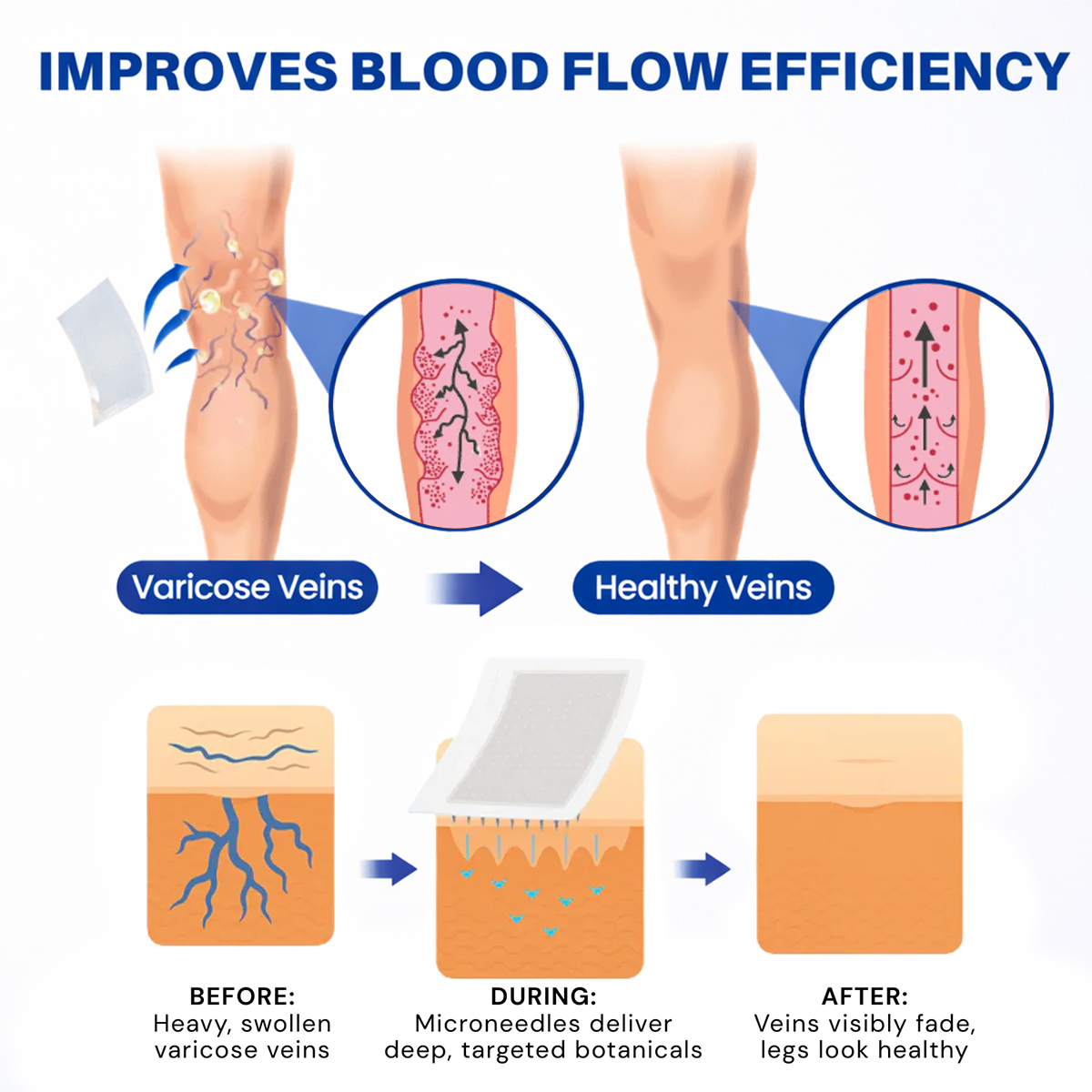 Lumivo® 𝑽𝗲𝗶𝙣 𝘾𝐨𝐧𝘁𝗼𝙪𝙧 𝙈𝙞𝐜𝐫𝒐𝒏𝒆𝗲𝗱𝗹𝙚 𝙋𝙖𝐭𝐜𝒉 𝒘𝒊𝘁𝗵 𝗔𝙙𝙫𝙖𝙣𝙘𝐞𝐝 𝐃𝒊𝒐𝒔𝗺𝙞𝐧 & 𝑯𝒆𝘀𝗽𝗲𝙧𝙞𝙙𝙞𝐧 𝐃𝒆𝒍𝒊𝒗𝗲𝗿𝙮🌿𝟕-𝐃𝐚𝐲 𝐕𝐢𝐬𝐢𝐛𝐥𝐞 𝐑𝐞𝐬𝐮𝐥𝐭𝐬 𝐟𝐨𝐫 𝐕𝐚𝐫𝐢𝐜𝐨𝐬𝐞 𝐕𝐞𝐢𝐧𝐬