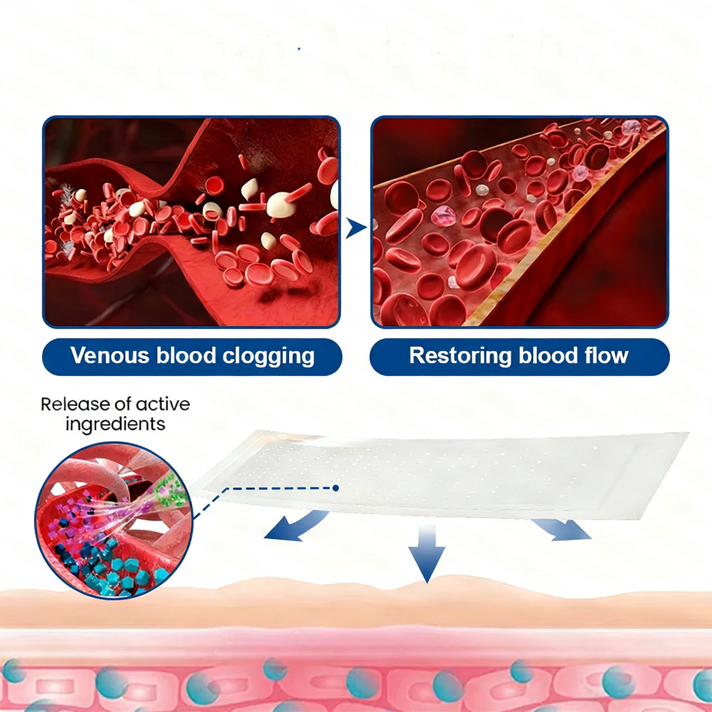 Lumivo® 𝑽𝗲𝗶𝙣 𝘾𝐨𝐧𝘁𝗼𝙪𝙧 𝙈𝙞𝐜𝐫𝒐𝒏𝒆𝗲𝗱𝗹𝙚 𝙋𝙖𝐭𝐜𝒉 𝒘𝒊𝘁𝗵 𝗔𝙙𝙫𝙖𝙣𝙘𝐞𝐝 𝐃𝒊𝒐𝒔𝗺𝙞𝐧 & 𝑯𝒆𝘀𝗽𝗲𝙧𝙞𝙙𝙞𝐧 𝐃𝒆𝒍𝒊𝒗𝗲𝗿𝙮🌿𝟕-𝐃𝐚𝐲 𝐕𝐢𝐬𝐢𝐛𝐥𝐞 𝐑𝐞𝐬𝐮𝐥𝐭𝐬 𝐟𝐨𝐫 𝐕𝐚𝐫𝐢𝐜𝐨𝐬𝐞 𝐕𝐞𝐢𝐧𝐬